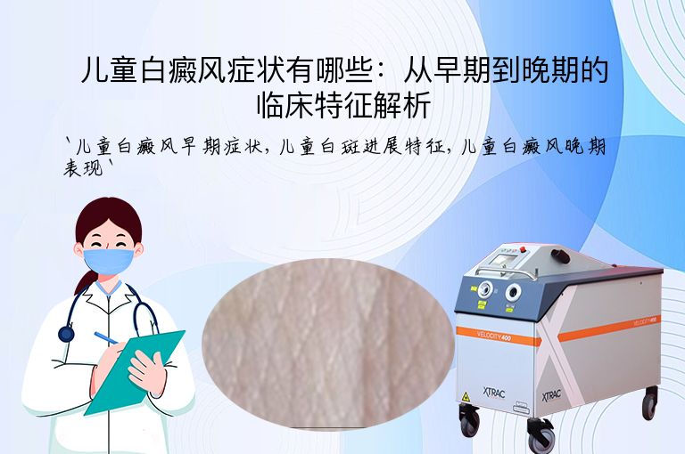 儿童白癜风症状有哪些:从早期到晚期的临床特征解析