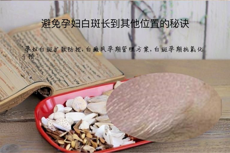避免孕妇白斑长到其他位置的秘诀