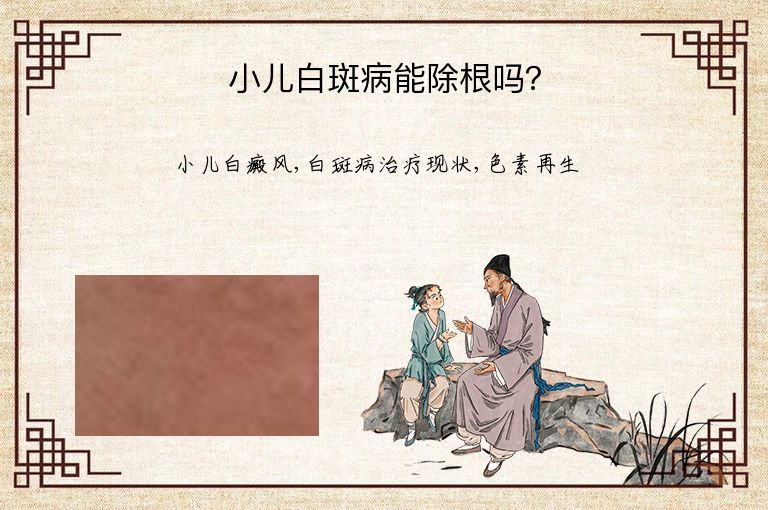 小儿白斑病能除根吗?”