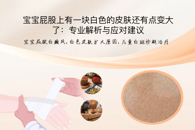 宝宝屁股上有一块白色的皮肤还有点变大了:专业解析与应对建议”