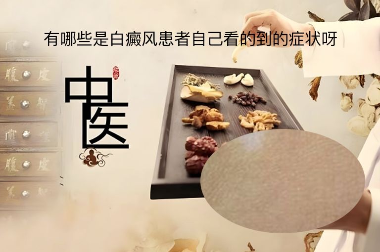 https://www.bdfsjzyy.com/d/file/p/77b06f7c2db94548df98111283075451.jpeg