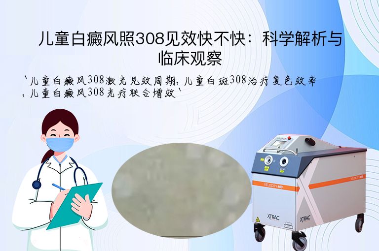 儿童白癜风照308见效快不快:科学解析与临床观察