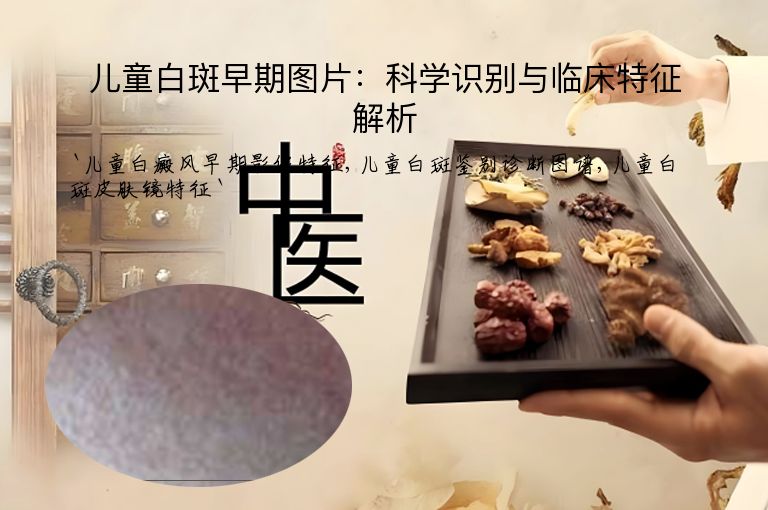 儿童白斑早期图片:科学识别与临床特征解析