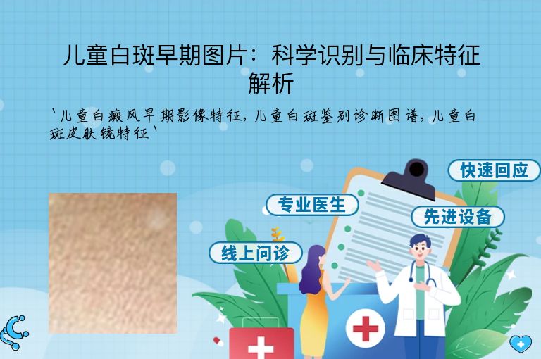 儿童白斑早期图片:科学识别与临床特征解析