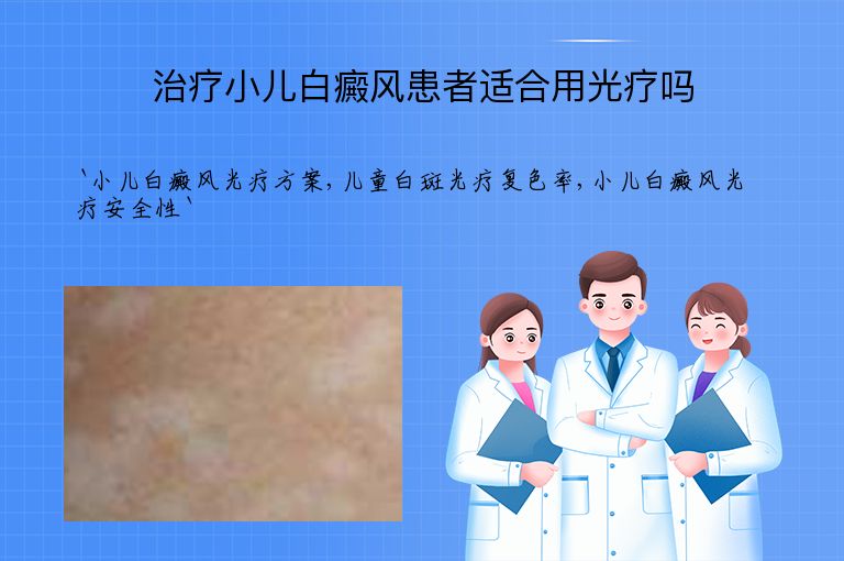 治疗小儿白癜风患者适合用光疗吗
