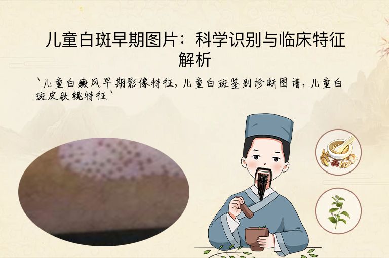 儿童白斑早期图片:科学识别与临床特征解析
