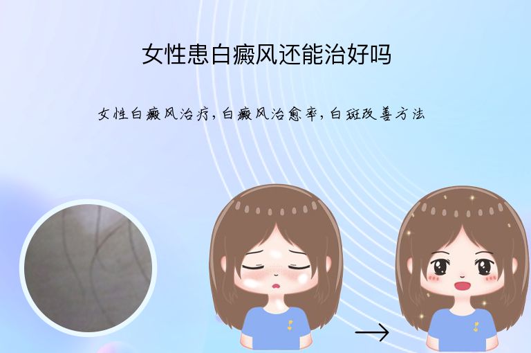 女性患白癜风还能治好吗”