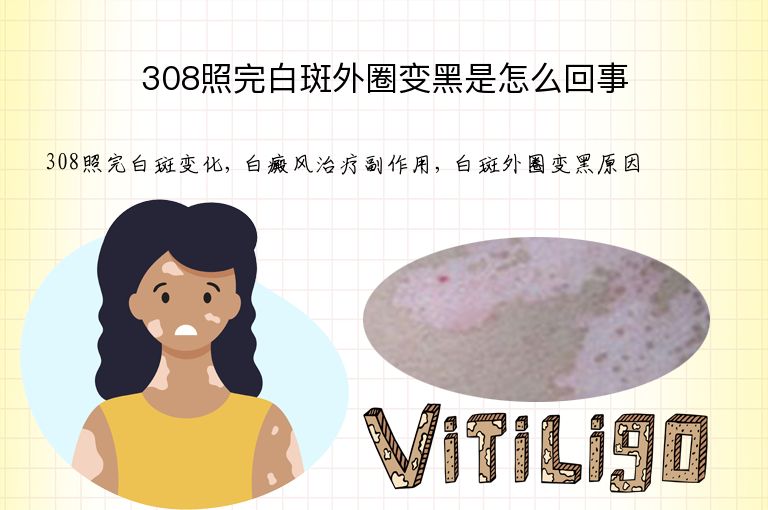 https://www.bdfsjzyy.com/d/file/p/cc14b3a9e6510a57d42ce13d225179ab.jpeg