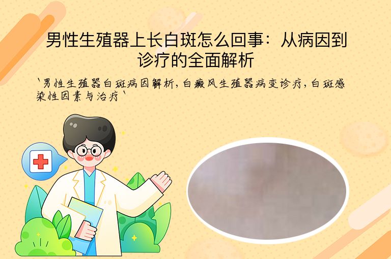 男性生殖器上长白斑怎么回事:从病因到诊疗的全面解析