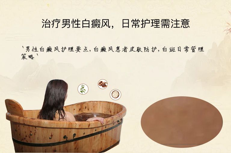 治疗男性白癜风，日常护理需注意