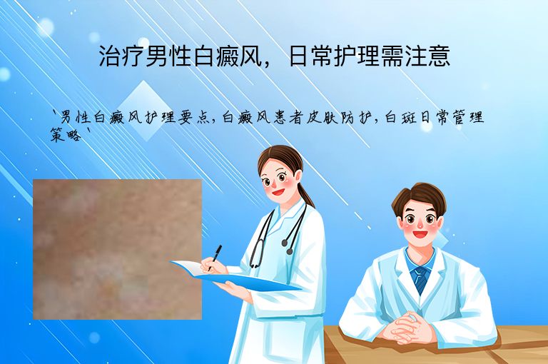 治疗男性白癜风,日常护理需注意