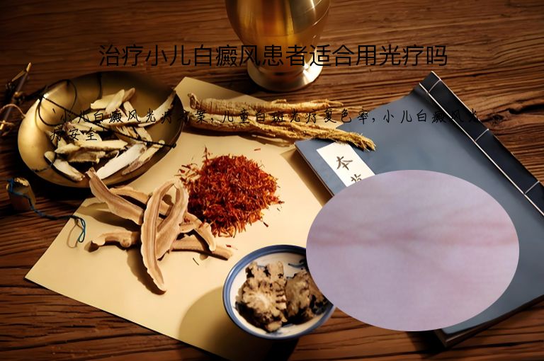 治疗小儿白癜风患者适合用光疗吗