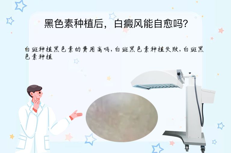 https://www.bdfsjzyy.com/d/file/p/3e2e55f06f7b2bf14c7bfe9a24bc723c.jpeg