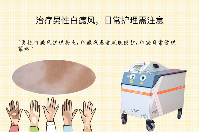 治疗男性白癜风,日常护理需注意