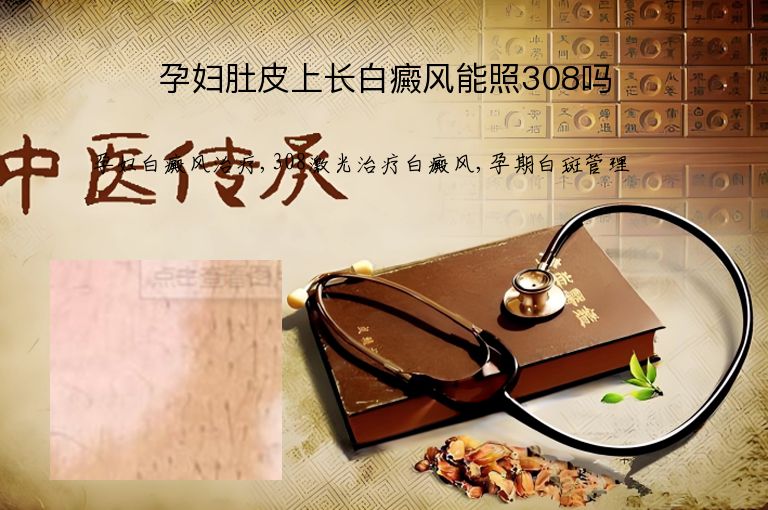 https://www.bdfsjzyy.com/d/file/p/6587e0e8d8ea0ad02865e78803a49d66.jpeg