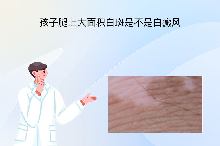 https://www.bdfsjzyy.com/d/file/p/c9d2871fd9539af5dacede9171192d77.jpeg