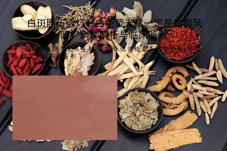 白斑照伍德灯有白色荧光就一定是白癜风吗？科学解析与临床鉴别”