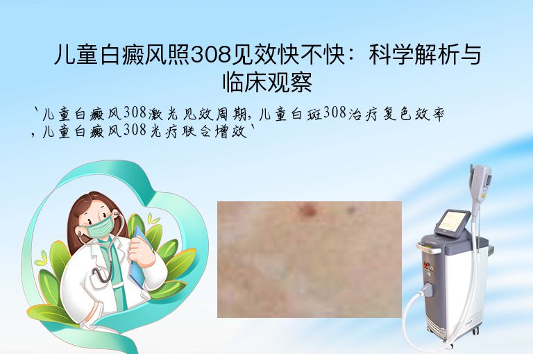 儿童白癜风照308见效快不快：科学解析与临床观察