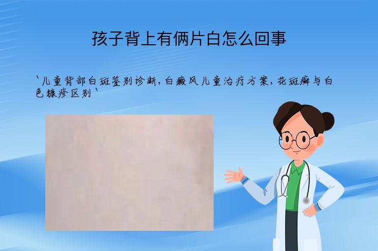 孩子背上有俩片白怎么回事
