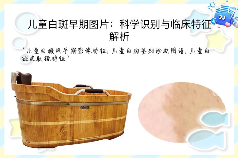 儿童白斑早期图片:科学识别与临床特征解析