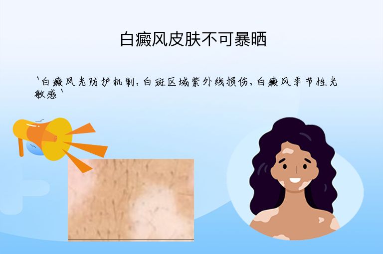 白癜风皮肤不可暴晒