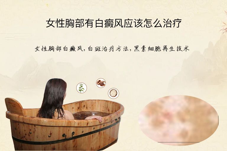 女性胸部有白癜风应该怎么治疗”