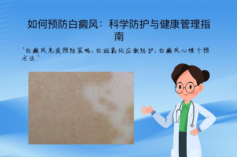 如何预防白癜风：科学防护与健康管理指南