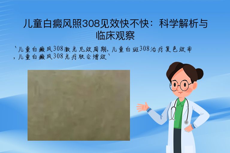 儿童白癜风照308见效快不快:科学解析与临床观察