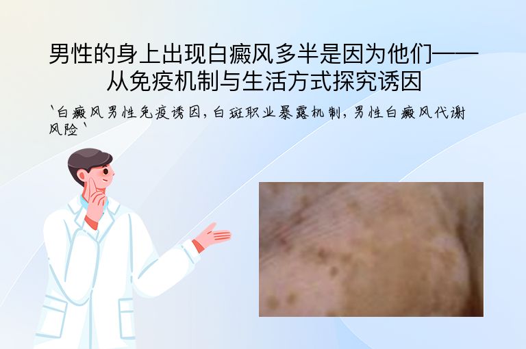 男性的身上出现白癜风多半是因为他们——从免疫机制与生活方式探究诱因