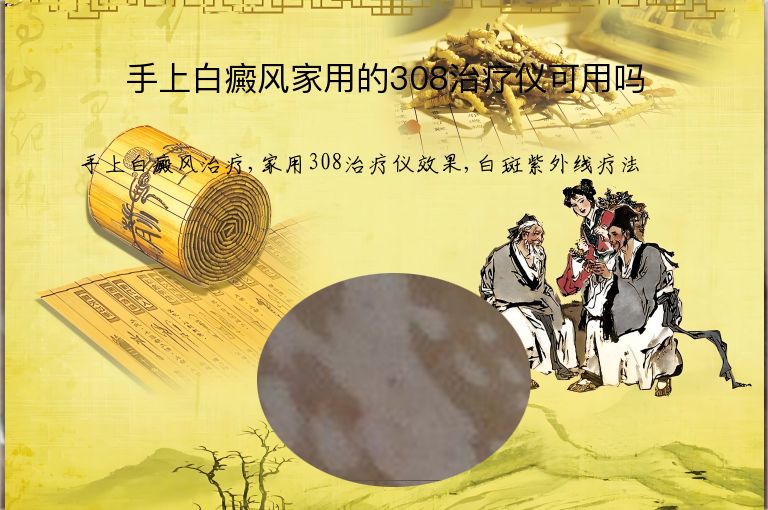 手上白癜风家用的308治疗仪可用吗”