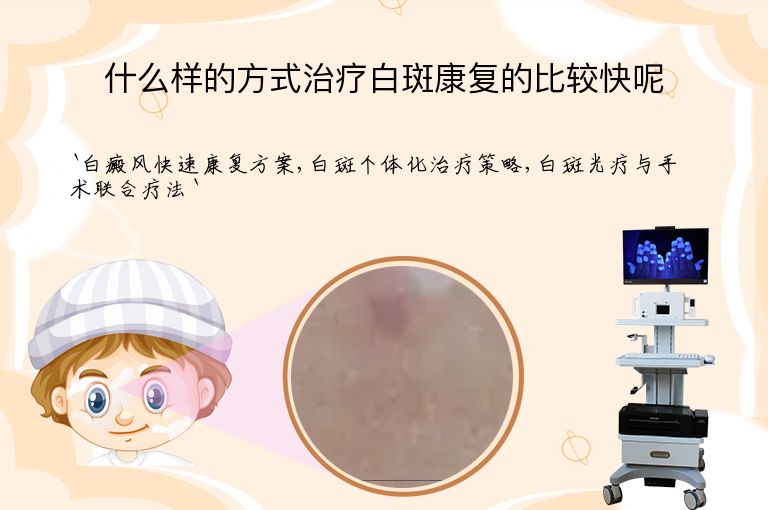什么样的方式治疗白斑康复的比较快呢