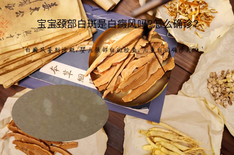 宝宝颈部白斑是白癜风吗?怎么确诊?”