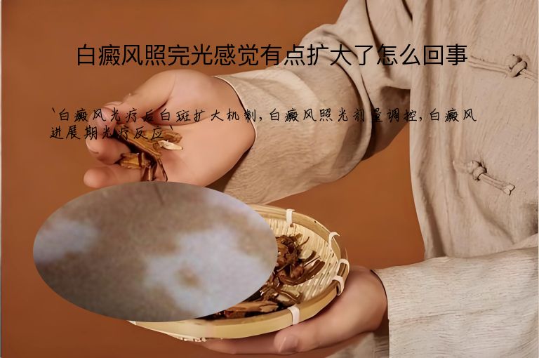白癜风照完光感觉有点扩大了怎么回事”