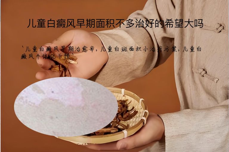 儿童白癜风早期面积不多治好的希望大吗”