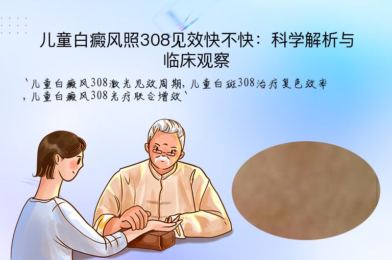 儿童白癜风照308见效快不快：科学解析与临床观察