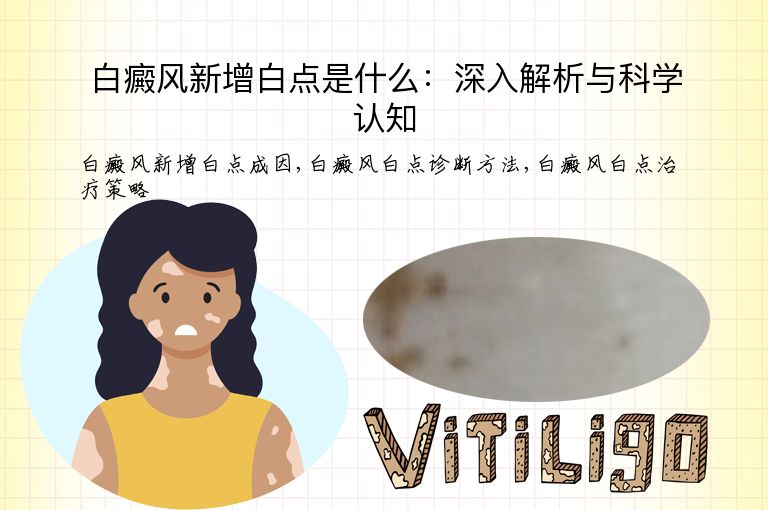 白癜风新增白点是什么:深入解析与科学认知”