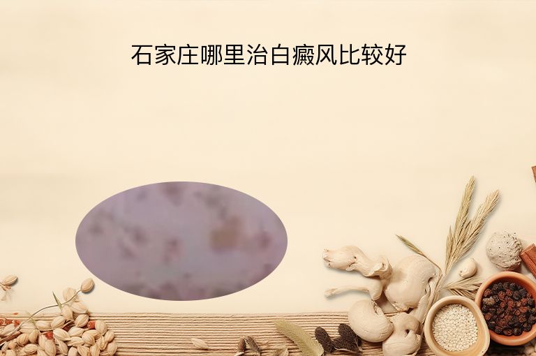 石家庄哪里治白癜风比较好”