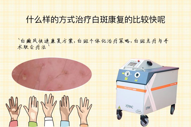 什么样的方式治疗白斑康复的比较快呢