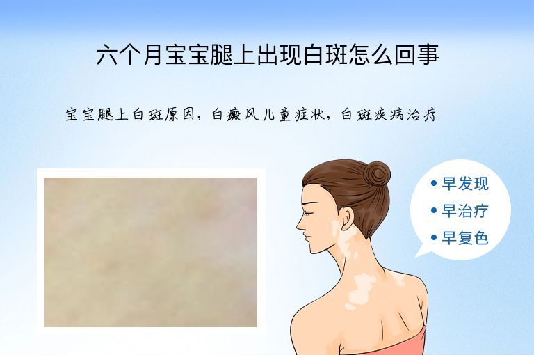 https://www.bdfsjzyy.com/d/file/p/a0db50e43d0321dec98057791e3d223d.jpeg
