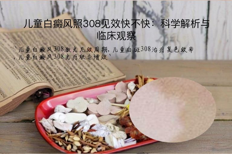 儿童白癜风照308见效快不快:科学解析与临床观察