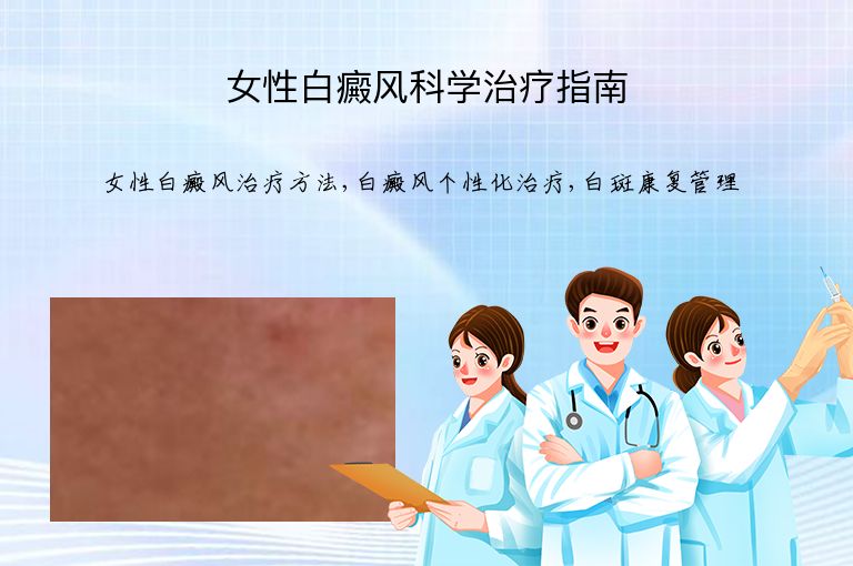 女性白癜风科学治疗指南”