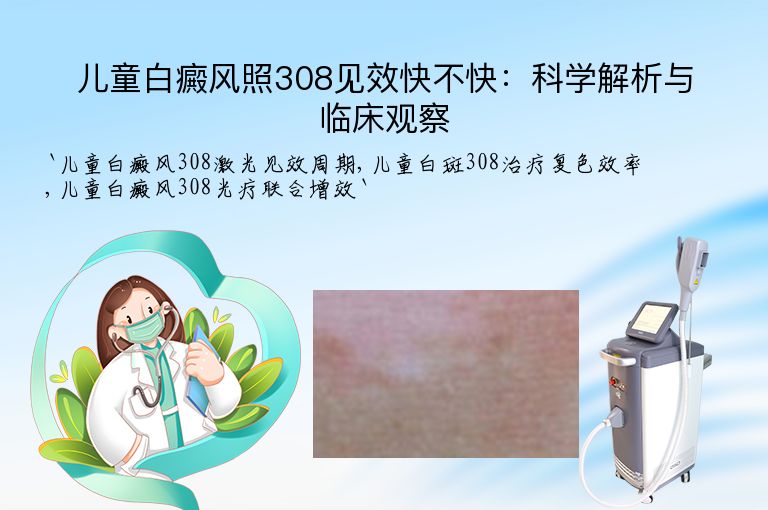 儿童白癜风照308见效快不快:科学解析与临床观察