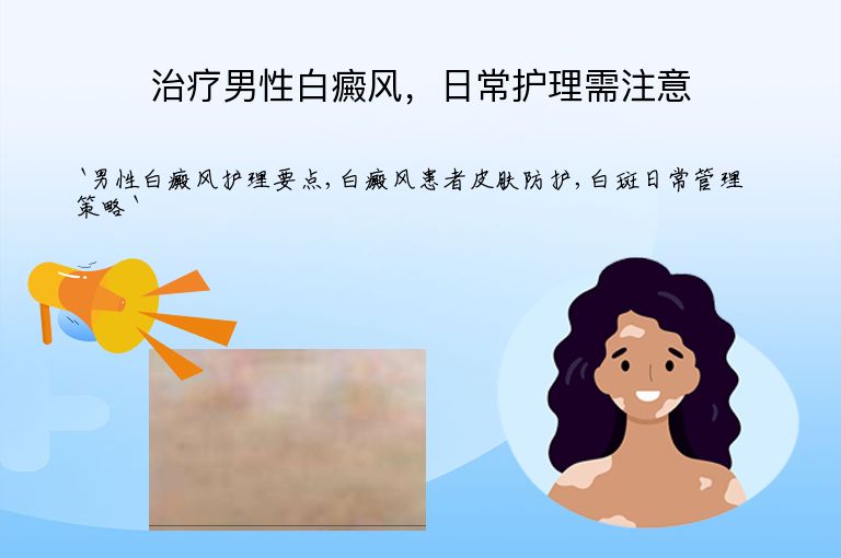 治疗男性白癜风,日常护理需注意