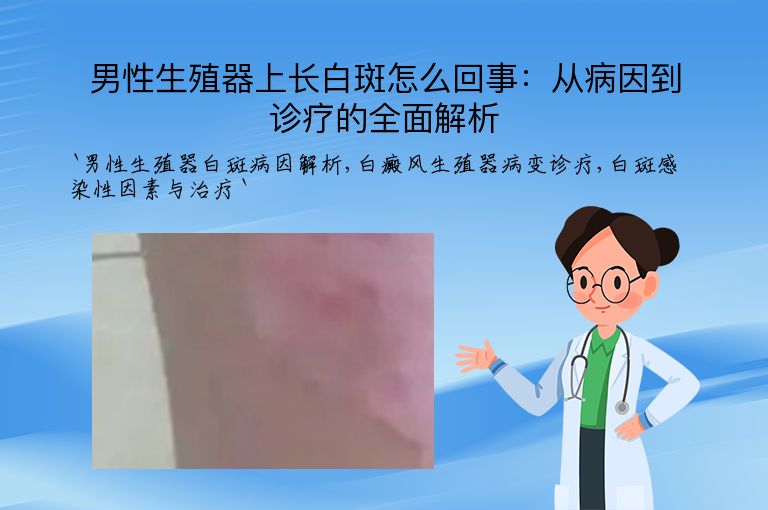 男性生殖器上长白斑怎么回事：从病因到诊疗的全面解析