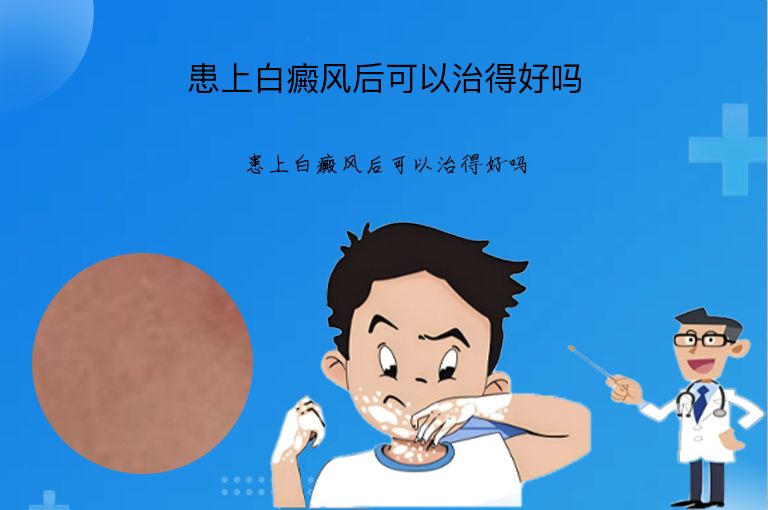 患上白癜风后可以治得好吗”