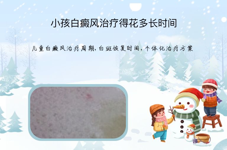 小孩白癜风治疗得花多长时间”