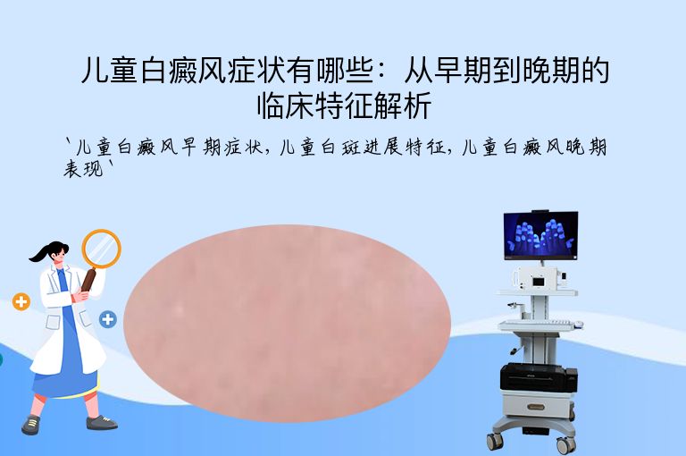 儿童白癜风症状有哪些:从早期到晚期的临床特征解析