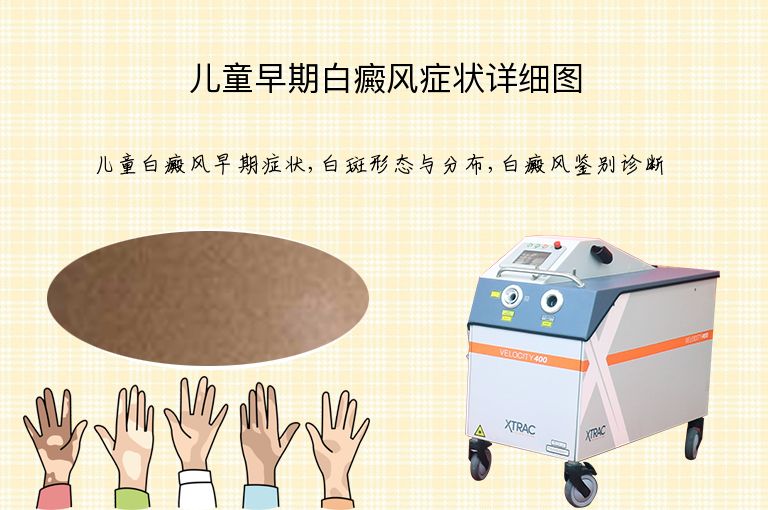 儿童早期白癜风症状详细图”