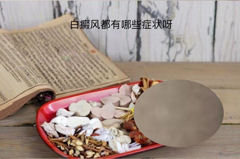 白癜风都有哪些症状呀