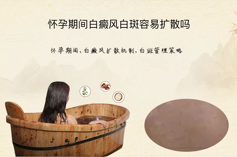 https://www.bdfsjzyy.com/d/file/p/30f93ce78e766550e0a687e6da871322.jpeg